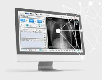 CareView Wireless Digital X-ray Panel - 14 x 17