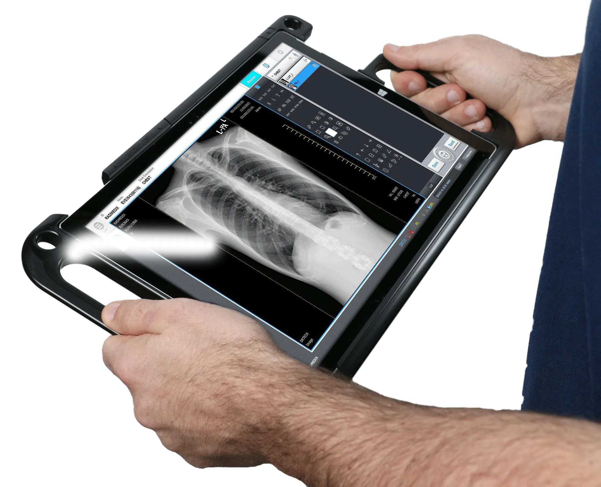 Digital Portable X-ray System - PowerPlus™ or HF120H 